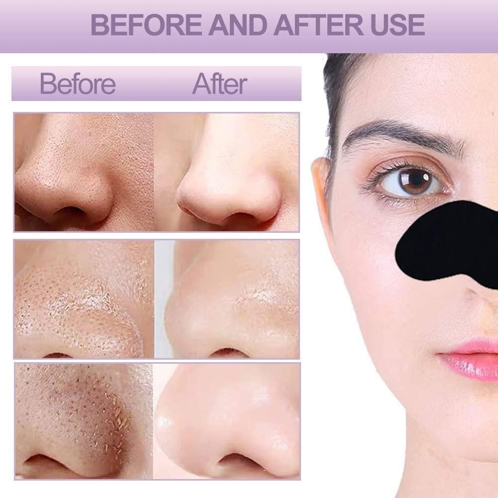 Cosmic Deep Cleansing Blackhead Remover Strips (Pack of 20)